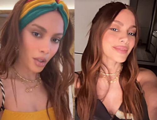 VISUAL TRANSFORMADO DE ANITTA GERA CHOQUE NAS REDES E LEVANTA ESPECULAÇÕES SOBRE PROCEDIMENTOS ESTÉTICOS